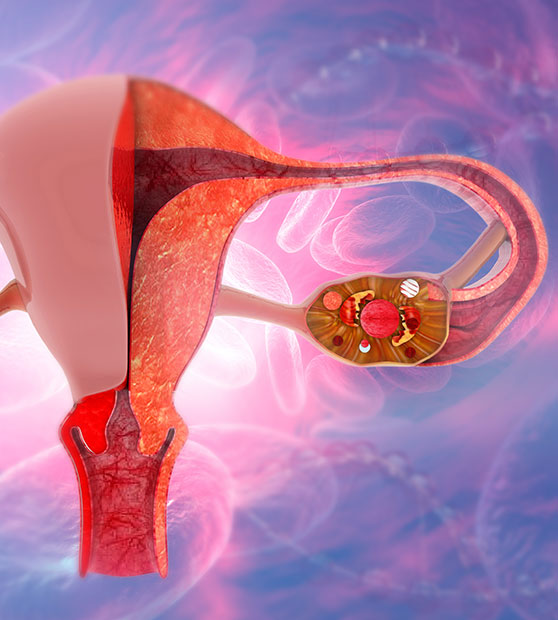 Intrauterine Abnormalities: Seek And Treat ?