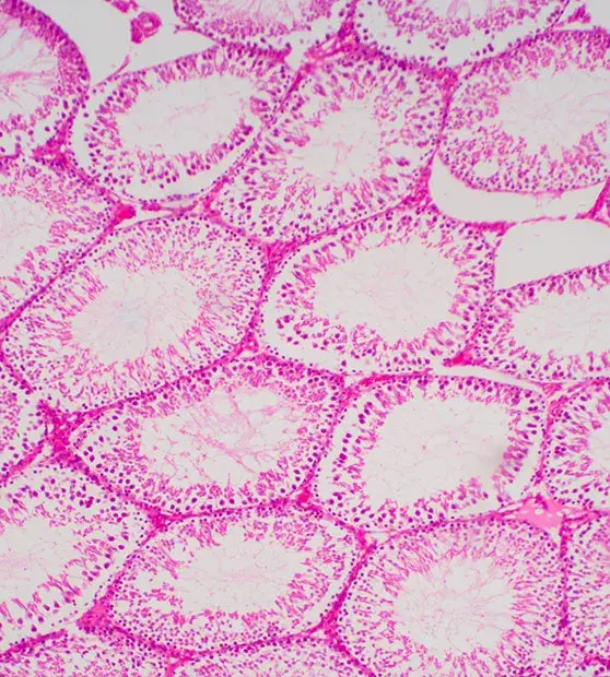 Testicular Biopsy