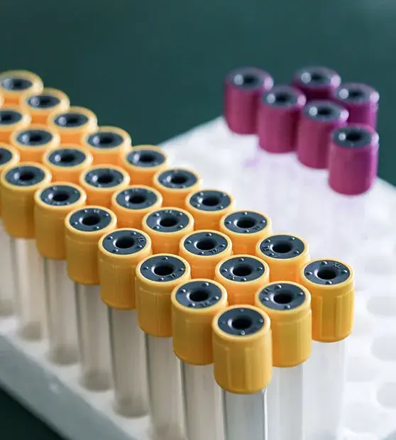Immunological Investigation