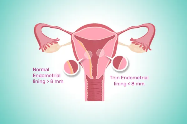 thin_endometrium_causes_symptoms_and_treatment_final