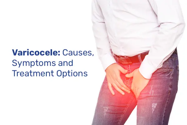 Varicocele: Causes, Symptoms and Treatment Options