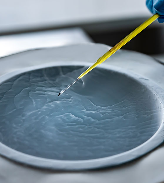 Fertility Preservation