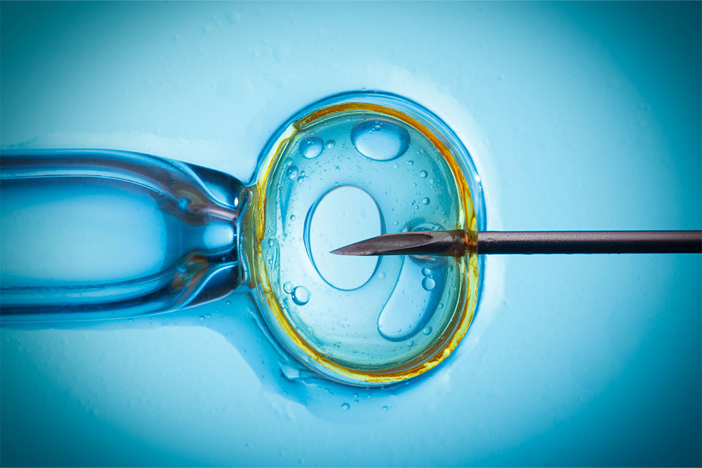 Differences-Between-IVF-and-IUI