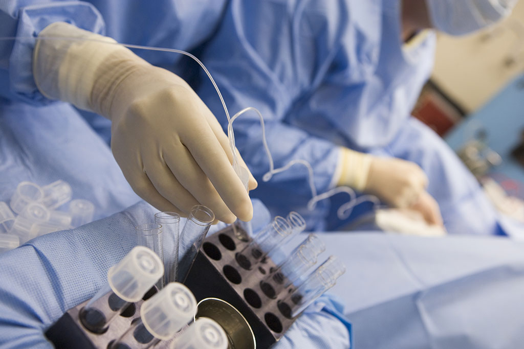 IVF Egg Retrieval