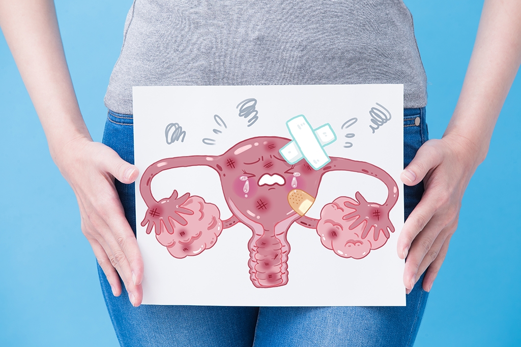 Uterus Didelphys Causes Symptoms and Treatment
