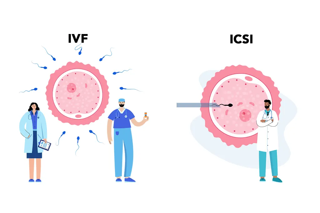 Difference Between ICSI and IVF