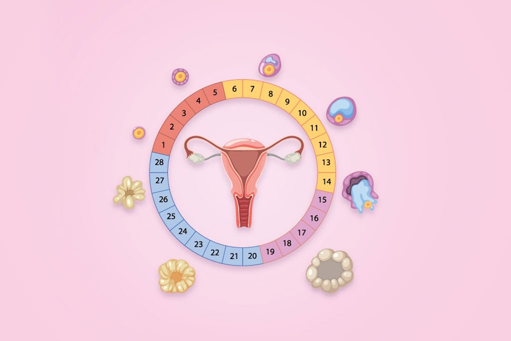 Luteal Phase Defects Causes Symptoms and Treatment
