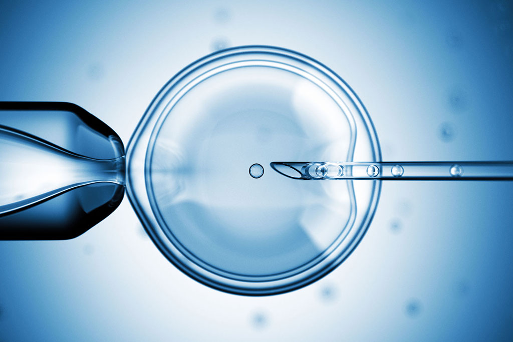 Poor Egg Quality Understanding Symptoms, Causes, and Treatment