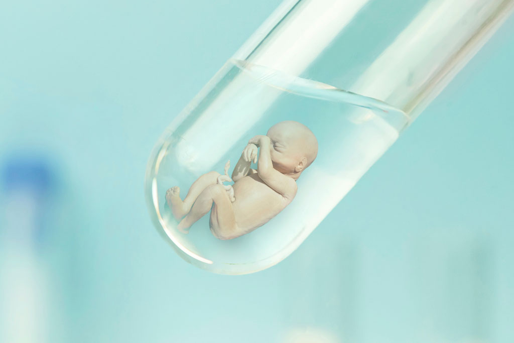 Test Tube baby Cost and Process