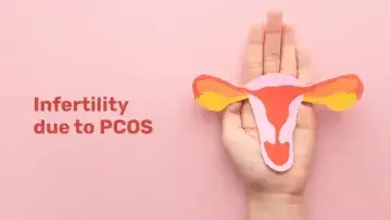 infertility-due-to-pcos-1