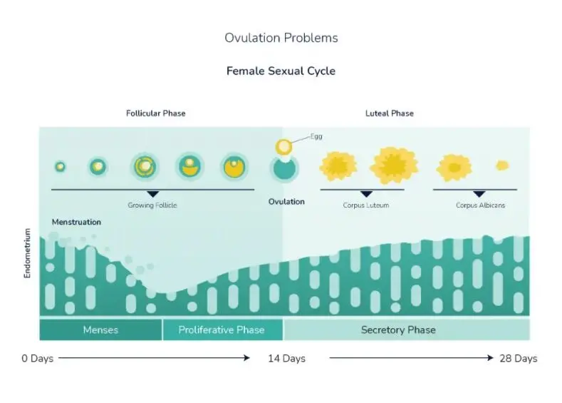 Infertility Caused by Ovulation Problem