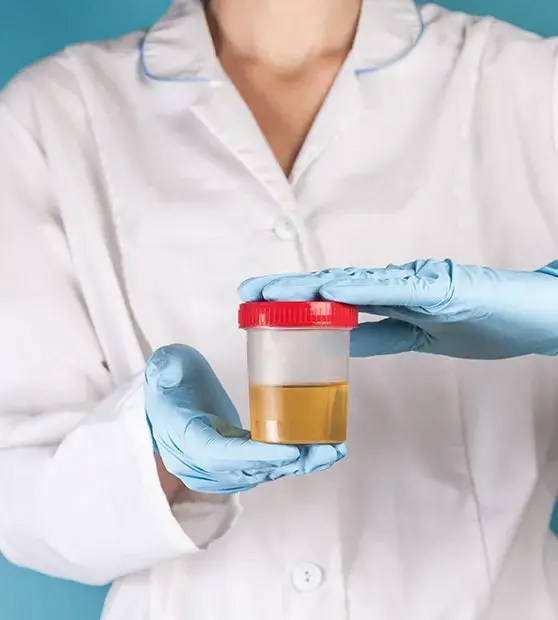 Post-Ejaculation Urinalysis