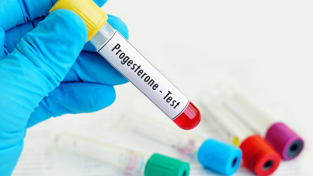 التحاليل المطلوبة عند تكرار الإجهاض التحاليل المطلوبة عند تكرار الإجهاض