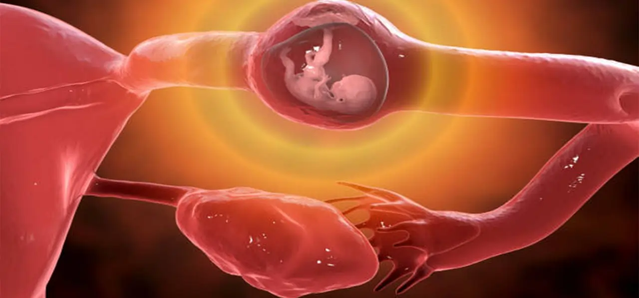 علاج الحمل خارج الرحم في دبي