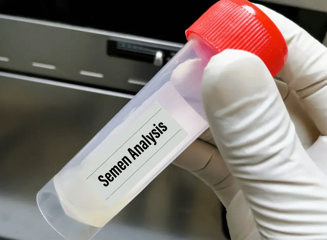مركز فحص حيوانات منوية في الإمارات: خدمات التشخيص والعلاج