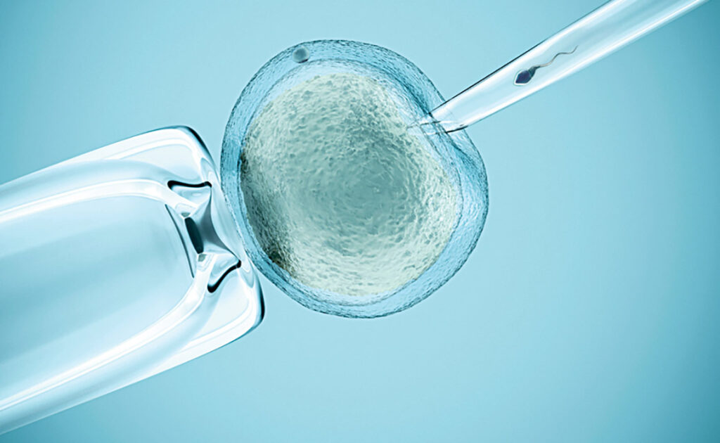 علاج العقم للنساء في الإمارات علاج العقم للنساء في الإمارات