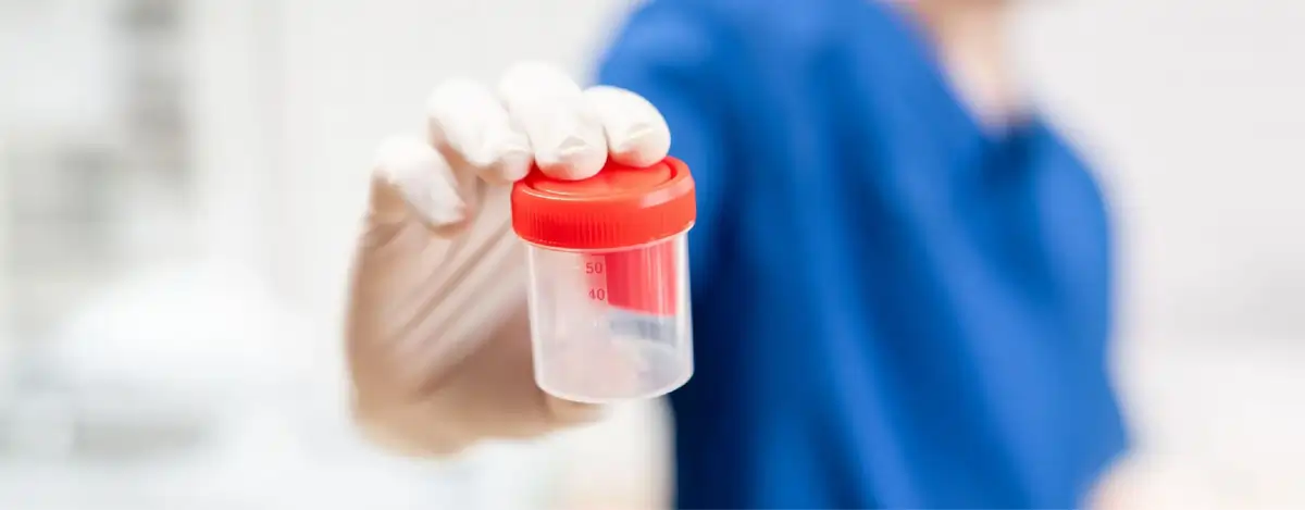 ما هي شروط تحليل السائل المنوي للرجل؟ خطوات مهمة لضمان&hellip;