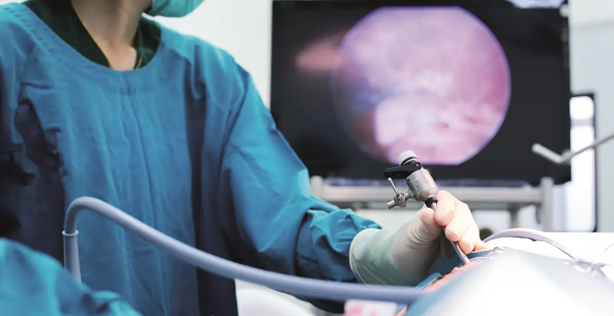 نصائح بعد عملية منظار الرحم 1