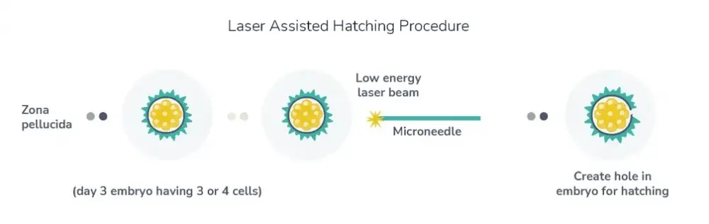 Assisted Hatching